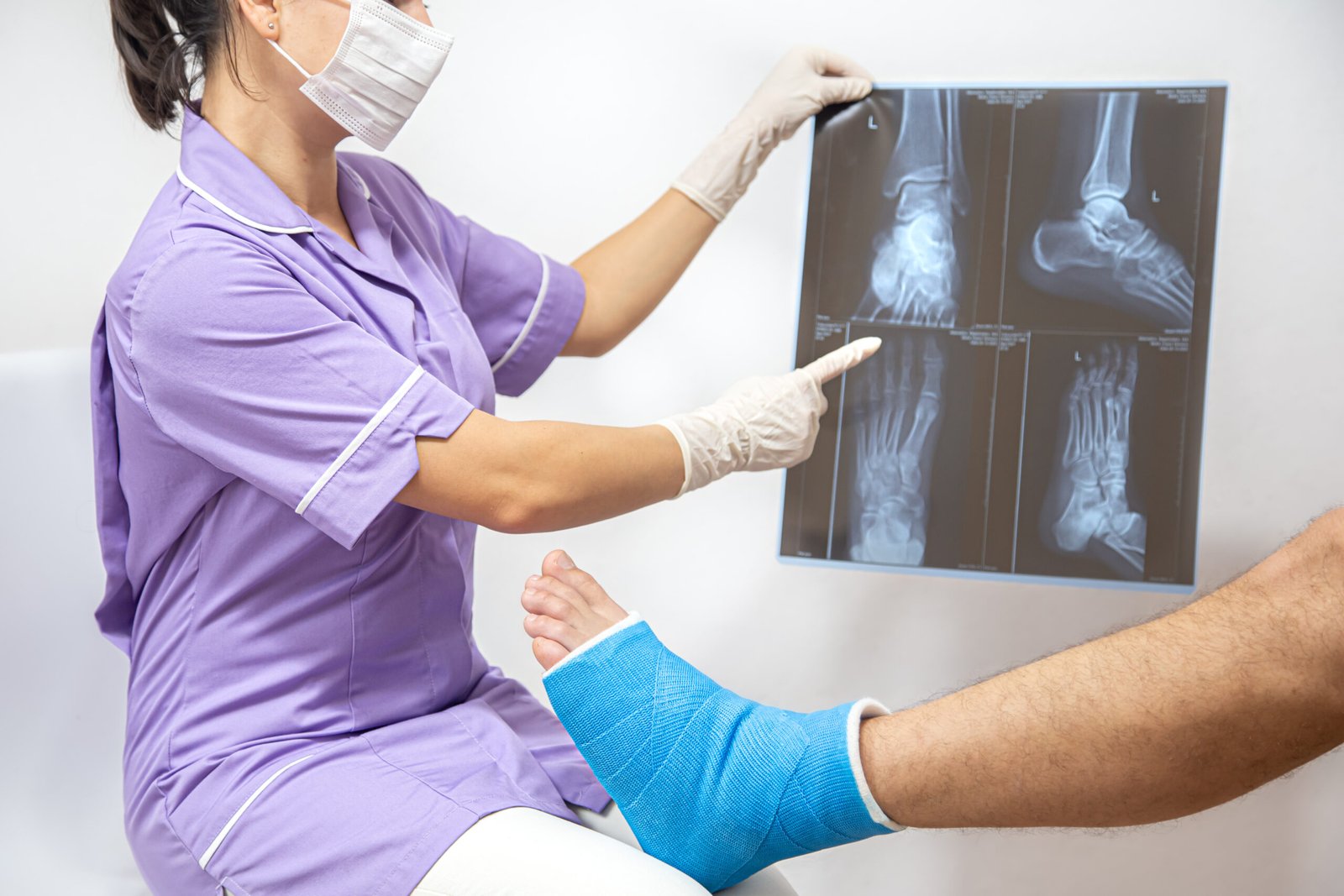 Female doctor in a blue medical gown checking broken leg and shows the male patient lateral projection x-ray of foot and ankle.